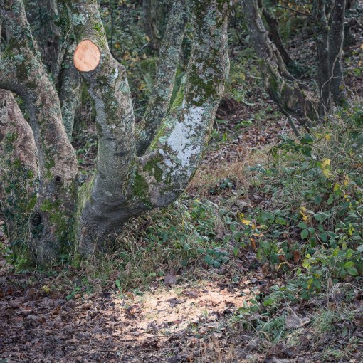 Amputation, Lydstep, Dyfed.